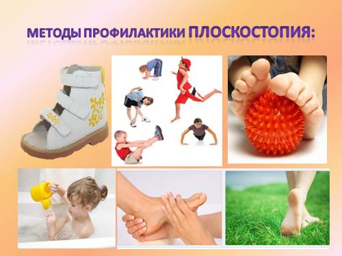 Профилактика и коррекция плоскостопия в детском саду Профилактика и коррекция плоскостопия в детском саду