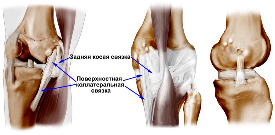 Повреждение коллатеральных связок коленного сустава: медиальной и ...