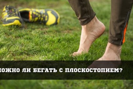 Можно ли заниматься бегом при плоскостопии и рекомендации для здоровья