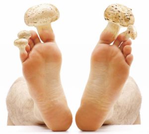 грибы ног