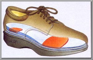 При диабетической стопе рекомендуется ношение специальной ортопедической обуви