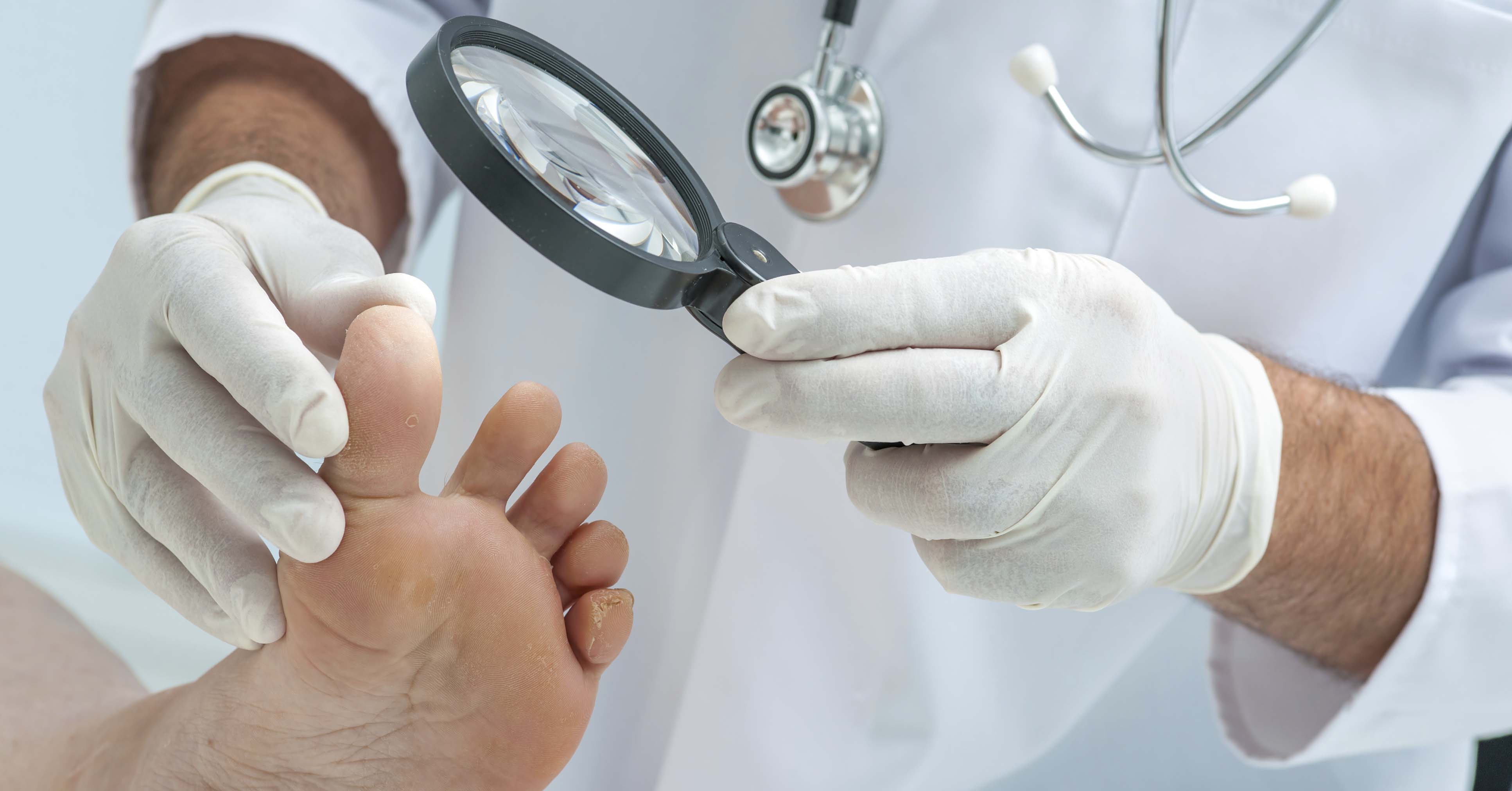 Врач лечение ногтей на ногах. Диагностика заболеваний. Методы диагностики грибковых заболеваний.