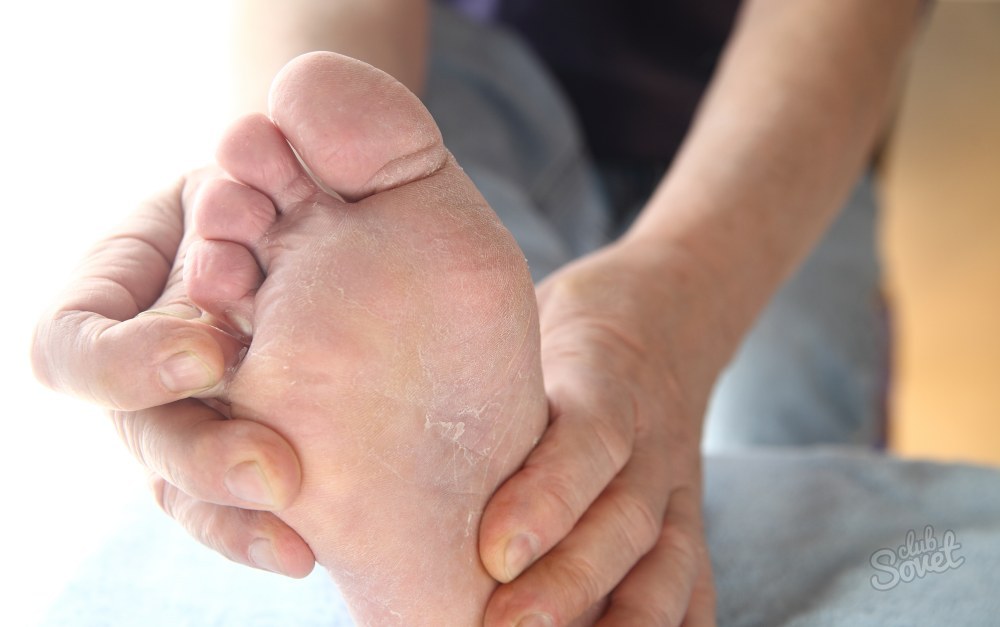 Почему облазит кожа на пальцах ног у взрослого: причины, лечение, фото