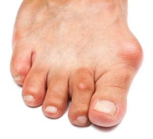 Боль в большом пальце ноги: причины и лечение
