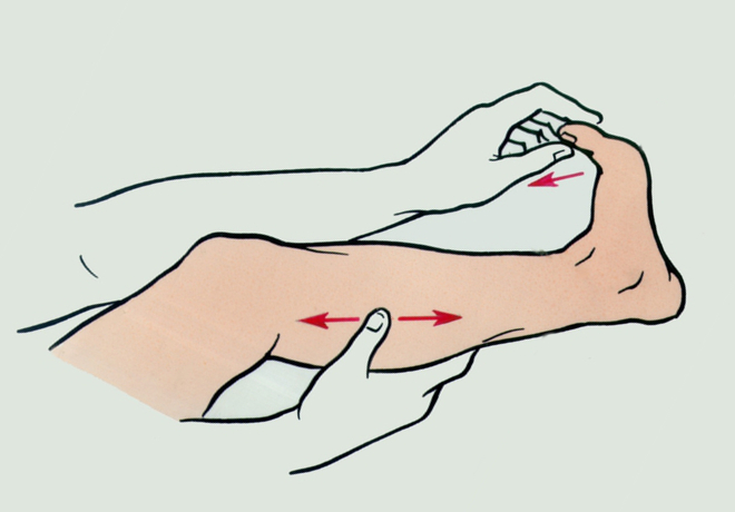 Сводит судорогой пальцы на ногах: причины и лечение