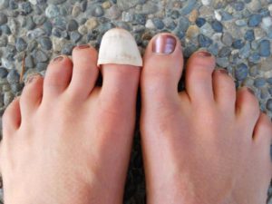 Удаление ногтя на ноге при грибке — все средства, как и чем