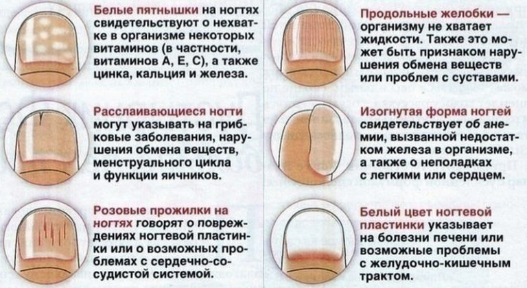Волнистая ногтевая пластина на большом пальце ноги: причины, лечение