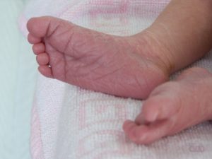 У ребенка шелушатся стопы ног 3 года thumbnail
