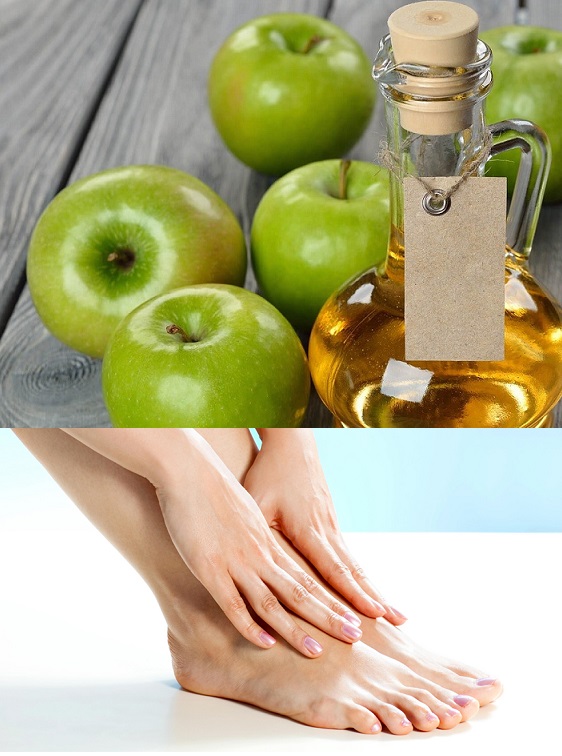 Как с помощью яблочного уксуса избавиться от потливости и запаха ног