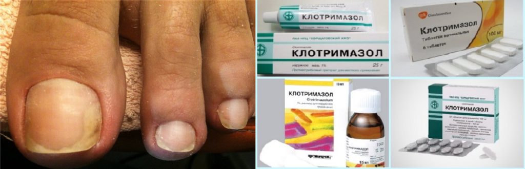 Лечение стопы ног: боли, отеки, опухоли, онемение