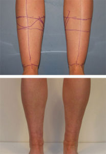 Упражнения для похудения щиколоток ног в домашних условиях