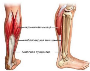 Камбаловидная мышца ног болит