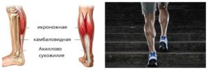 Функции икроножной мышцы ног