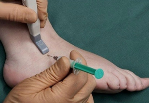 Гигрома в голеностопном суставе лечение народными средствами
