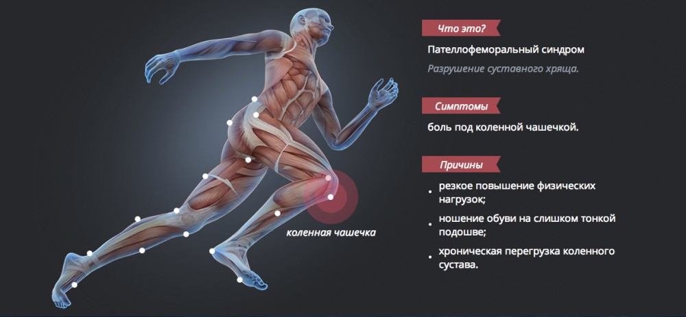 После бега болят колени что делать. Бег мышцы задействованы. Травмы бегуна. Мышцы задействованные при беге. Мышцы ног при беге.