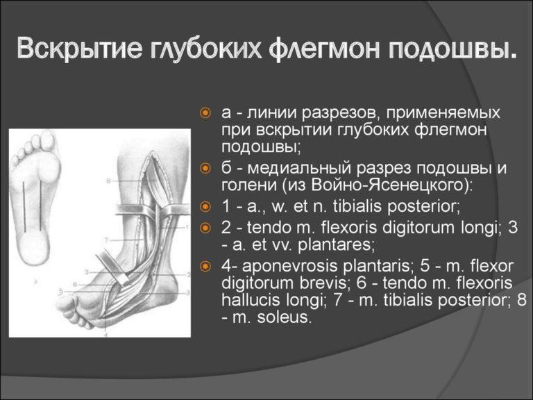 Флегмона после инъекции фото