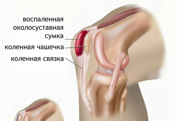 Разбитое сердце: картинка и фото разбитое сердце, скачать рисунки на Разбитое сердце: картинка и фото разбитое сердце, скачать рисунки на