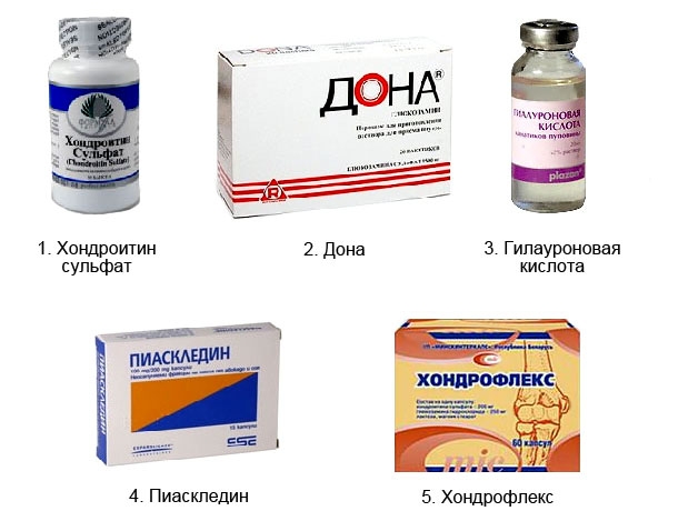 Препараты и мази при гонартрозе коленного сустава: уколы, витамины ...