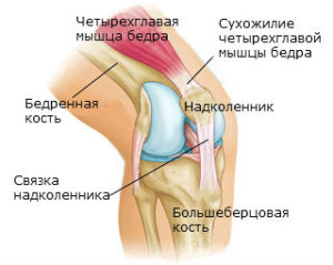 Изображение - Артроз коленных суставов код kolennaya-svyazka-300x239