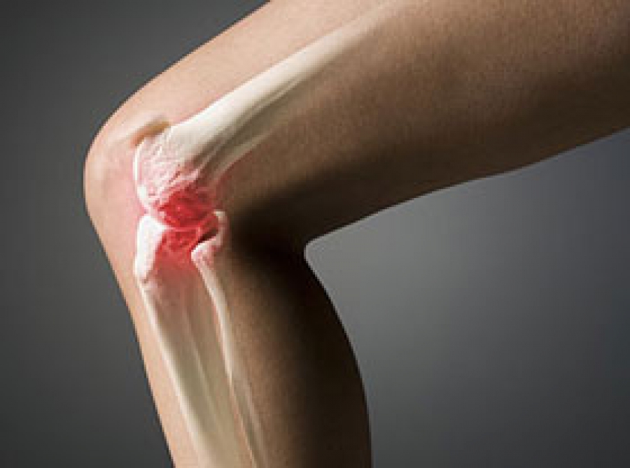 Разница между артритом и артрозом коленного сустава