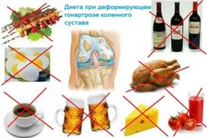 Запрещенные продукты при артрозе коленного сустава