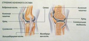 Блок коленного сустава как лечить