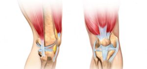 Лечение миозита коленного сустава