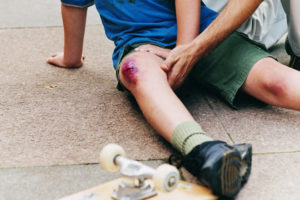 Лечение трещин в коленном суставе