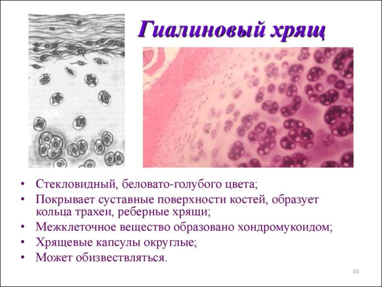 Болезнь гиалиновых мембран у новорожденных презентация