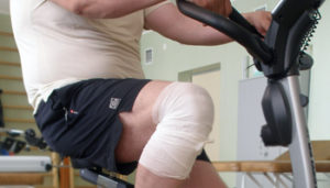 Как разработать колено после перелома: упражнения ЛФК и методы альтернативной терапии