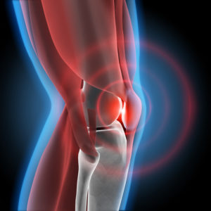 Лечение невралгии коленного сустава