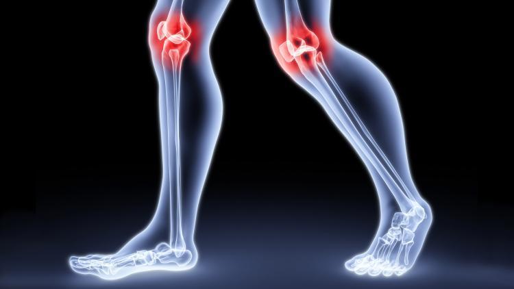 Как восстановить и нарастить хрящевую ткань коленного сустава
