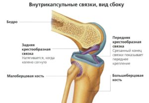 Изображение - Коллатеральные связки коленного сустава анатомия image-492-300x209