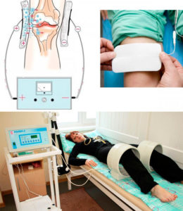 Физиолечение коленного сустава магнитом в домашних условиях