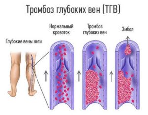 Причины отека ноги от колена до стопы