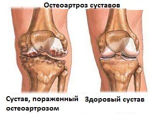 Болит выше колена с внутренней стороны