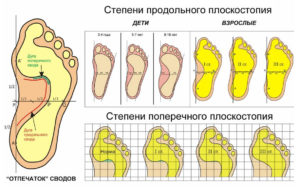 Горят ноги - о чем говорит этот симптом?