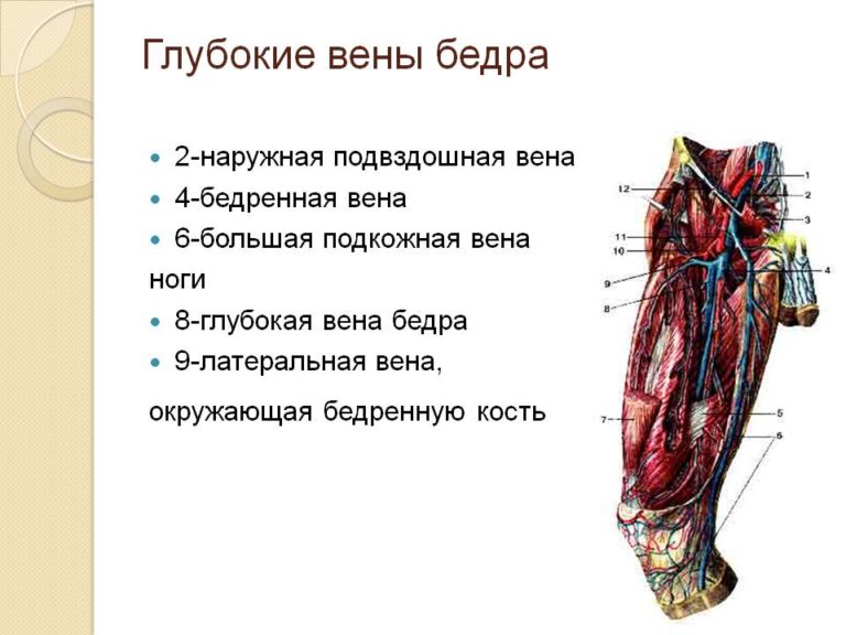 Тромбофлебит бедренной вены фото