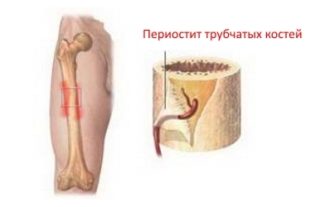 Болит нижняя часть коленного сустава