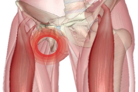 Причины болей в ноге от паха до колена по внутренней и внешней сторонам бедра