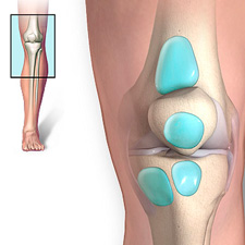 Признаки скопления жидкости в коленном суставе