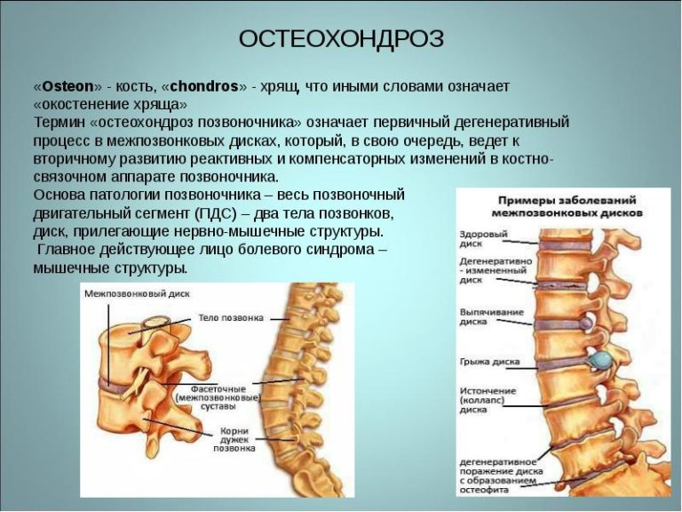 Где находится мениск в колене фото