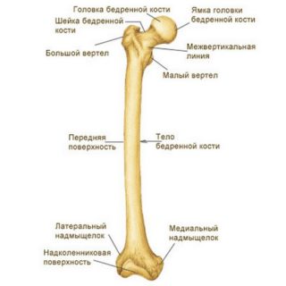 Перелом проксимального метаэпифиза бедренной кости