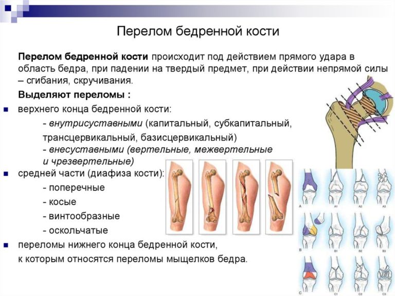 Карта вызова смп перелом бедра