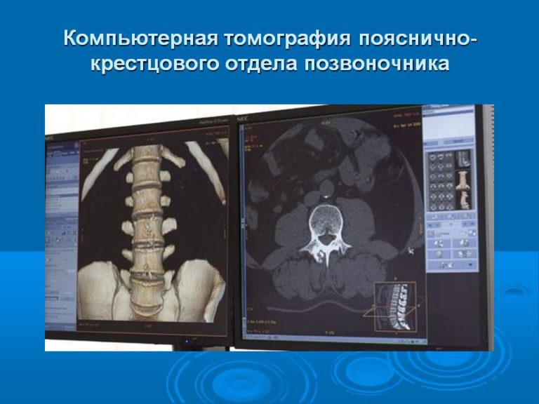 Компьютерная программа для лечения амблиопии крестики