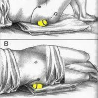 Особенности массажа при синдроме грушевидной мышцы thumbnail
