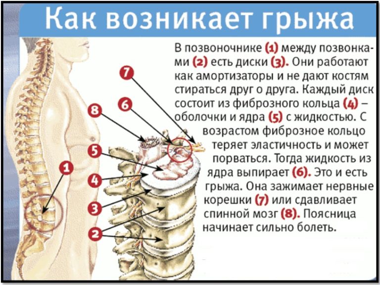 Что такое бедра у женщин фото