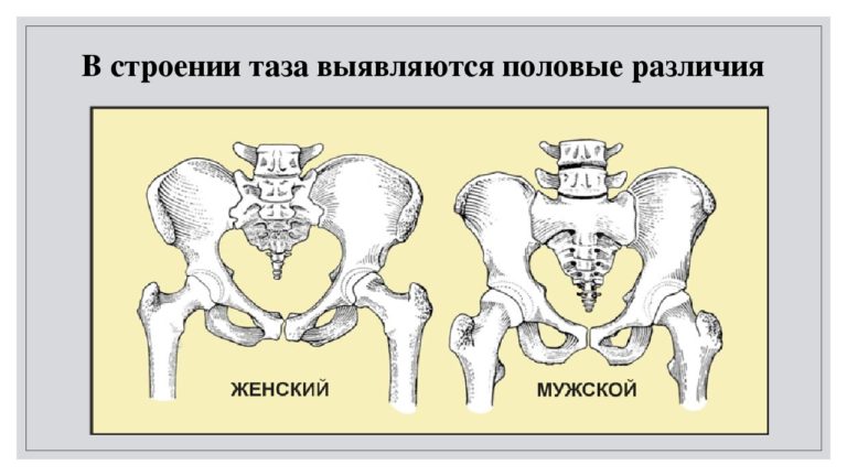 Пролежни на крестце фото