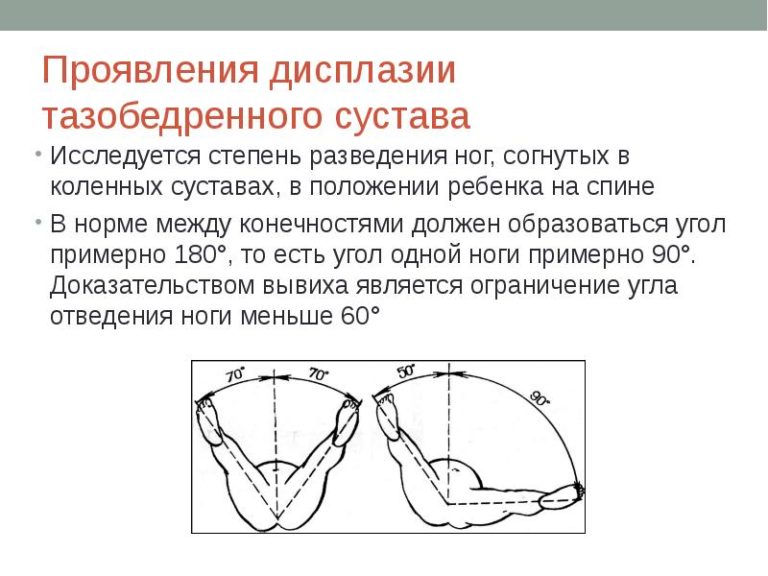 Распространенная ошибка при изображении рефлекса когда