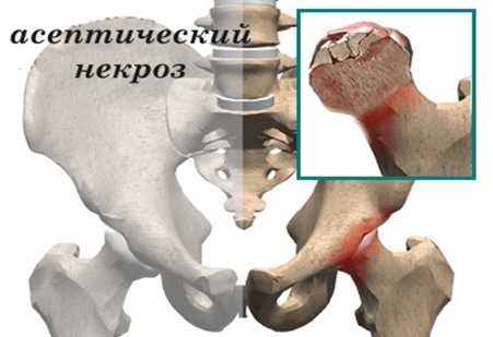 Болит тазобедренный сустав фото